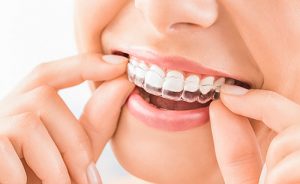 orthodontie tandartsen mariastraat