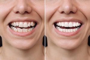 orthodontist in rotterdam